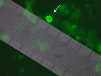 Cryptosporidium/Giardia